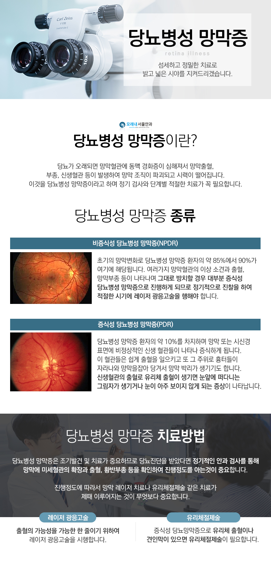 당뇨병성 망막증