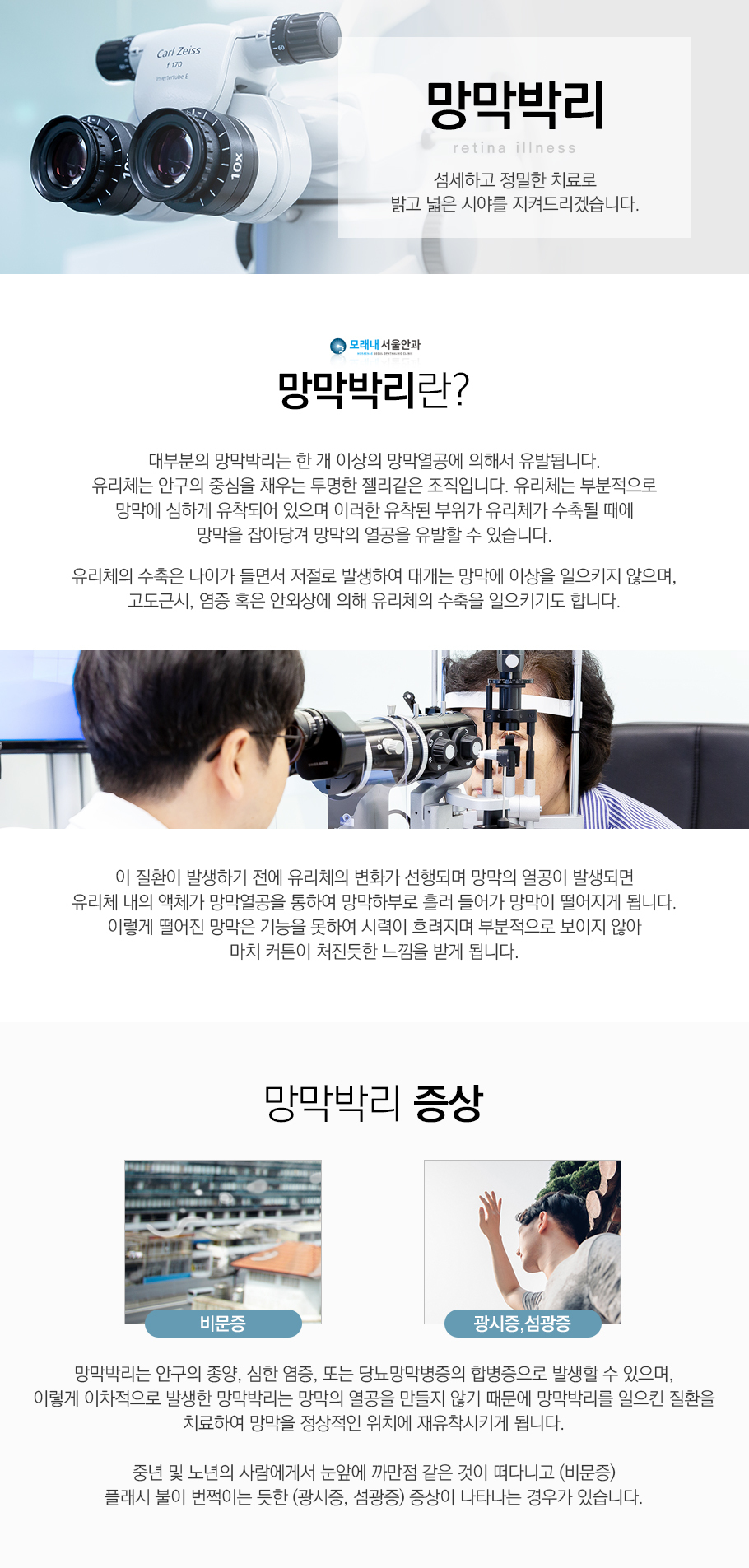 망막박리